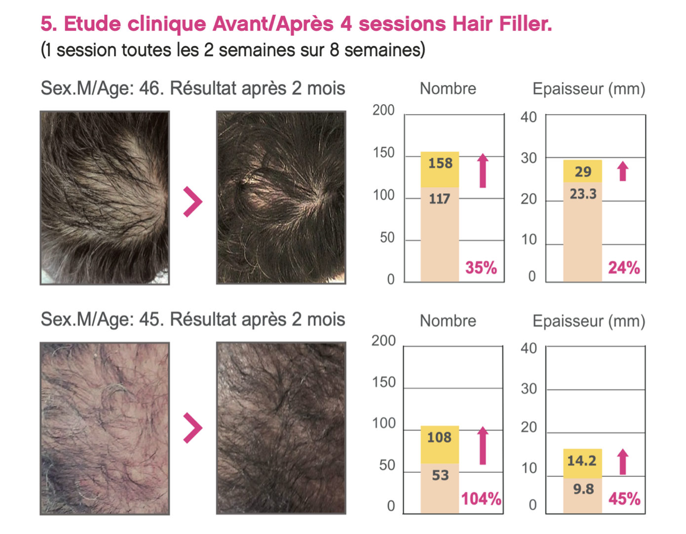 Purchase Dr Cyj Hair filler to treat hair loss Purchase Dr Cyj Hair filler to treat hair loss